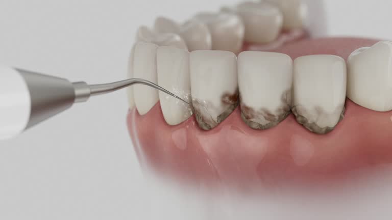Trusted Root Canal Treatment service in Cridersville, OH - Dentist Open Now